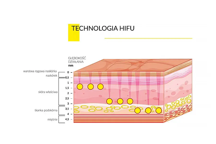 Niechirurgiczny lifting twarzy